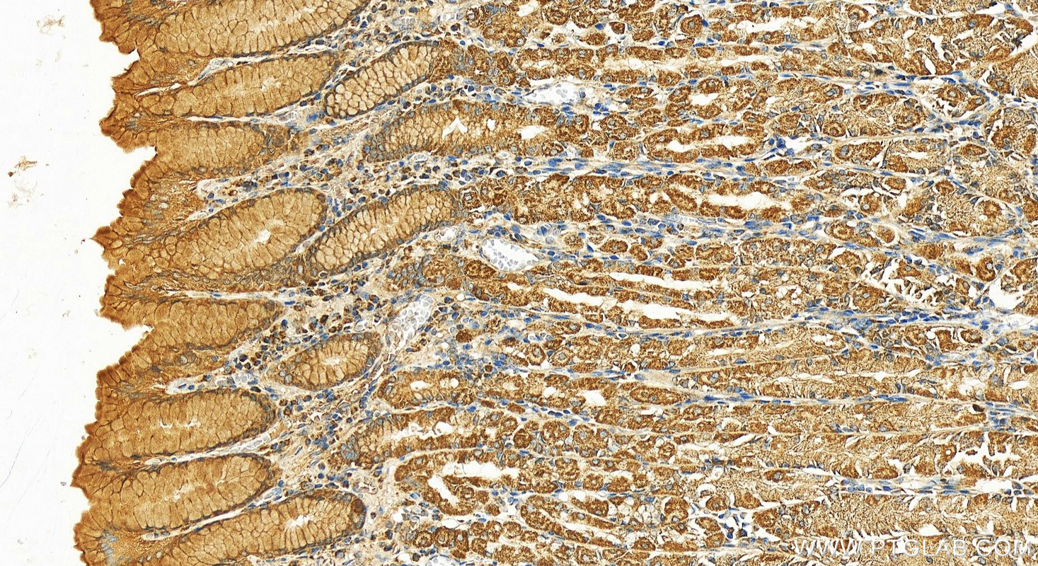 IHC staining of human stomach using 25061-1-AP