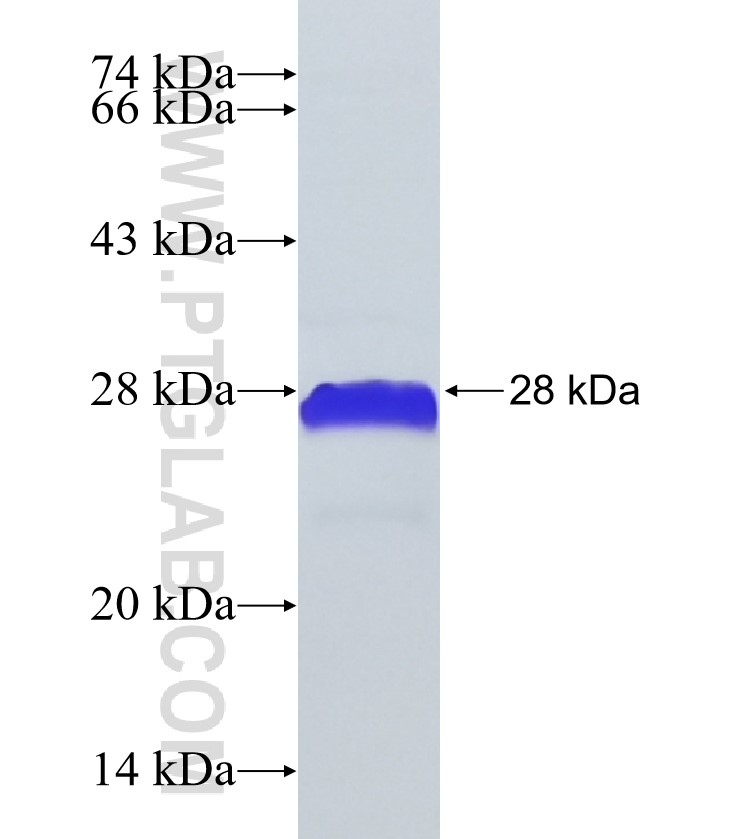 RNF139 fusion protein Ag21530 SDS-PAGE