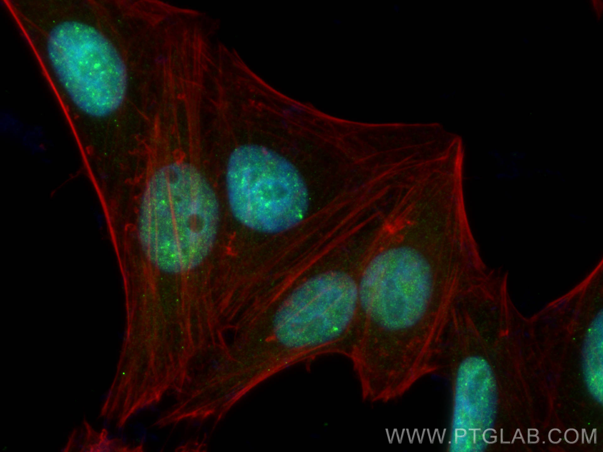 IF Staining of HepG2 using 21393-1-AP