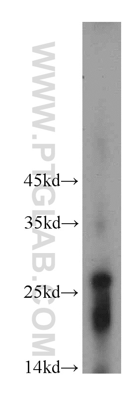 WB analysis of human placenta using 21024-1-AP