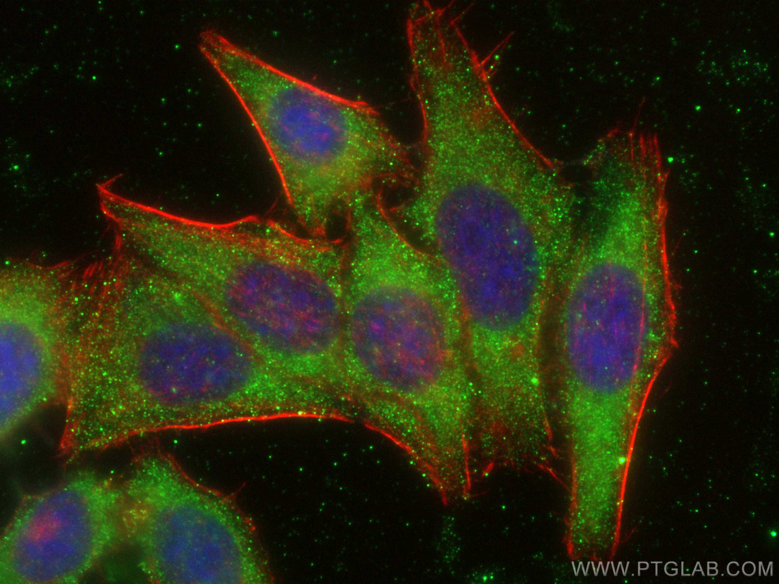 IF Staining of HepG2 using 20408-1-AP (same clone as 20408-1-PBS)