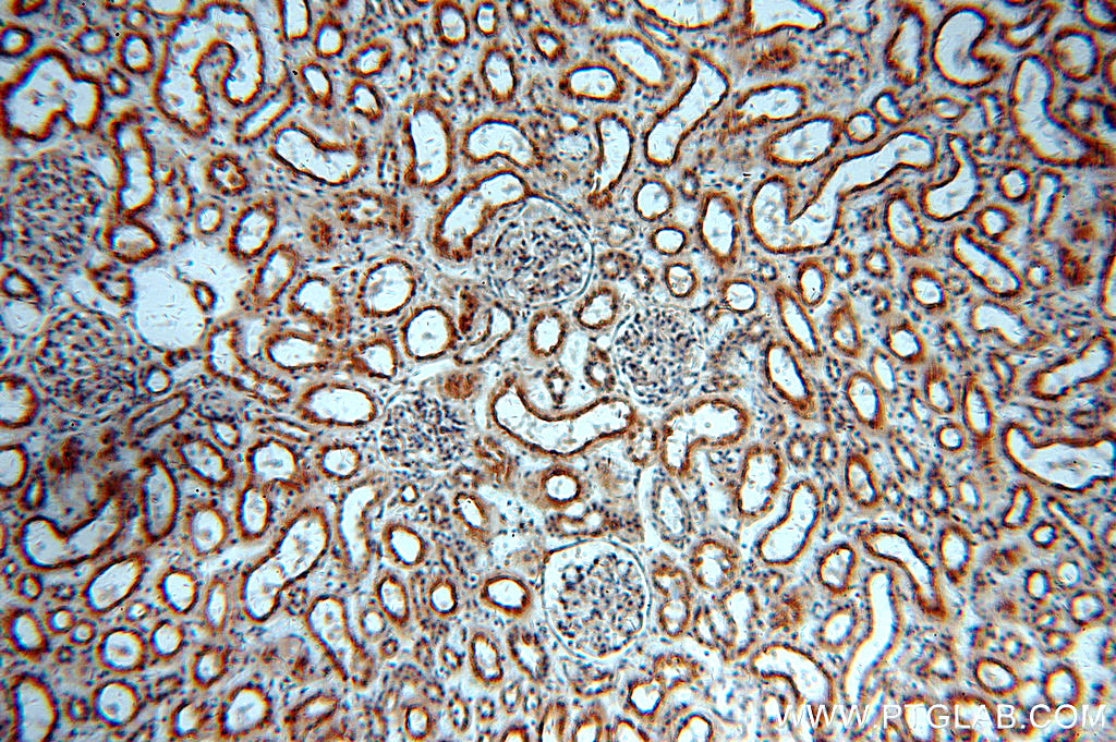 IHC staining of human kidney using 20408-1-AP (same clone as 20408-1-PBS)