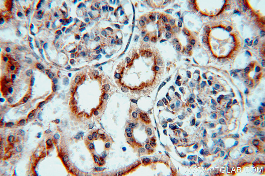 IHC staining of human kidney using 20408-1-AP (same clone as 20408-1-PBS)