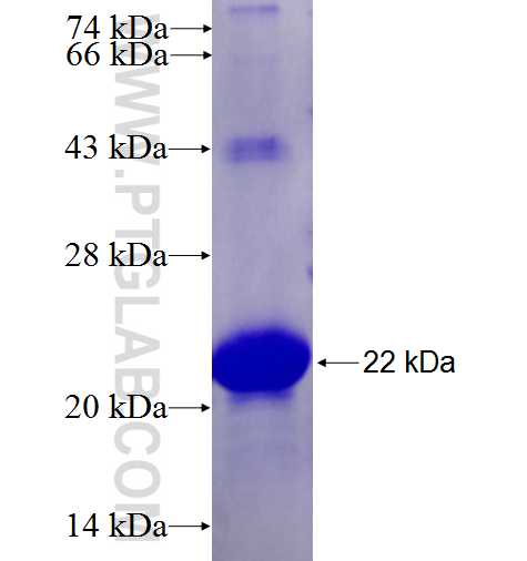 RNF182 fusion protein Ag27325 SDS-PAGE