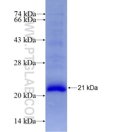 RNF186 fusion protein Ag27406 SDS-PAGE