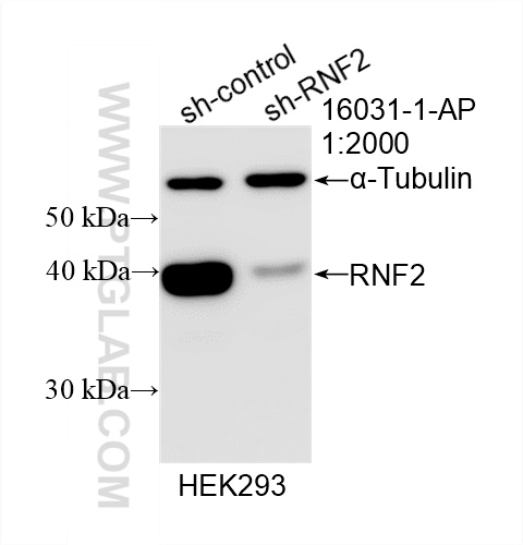 WB analysis of HEK-293 using 16031-1-AP