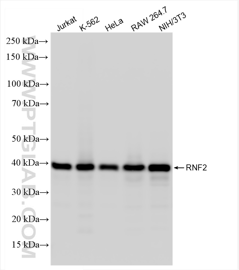 WB analysis using 84793-5-RR