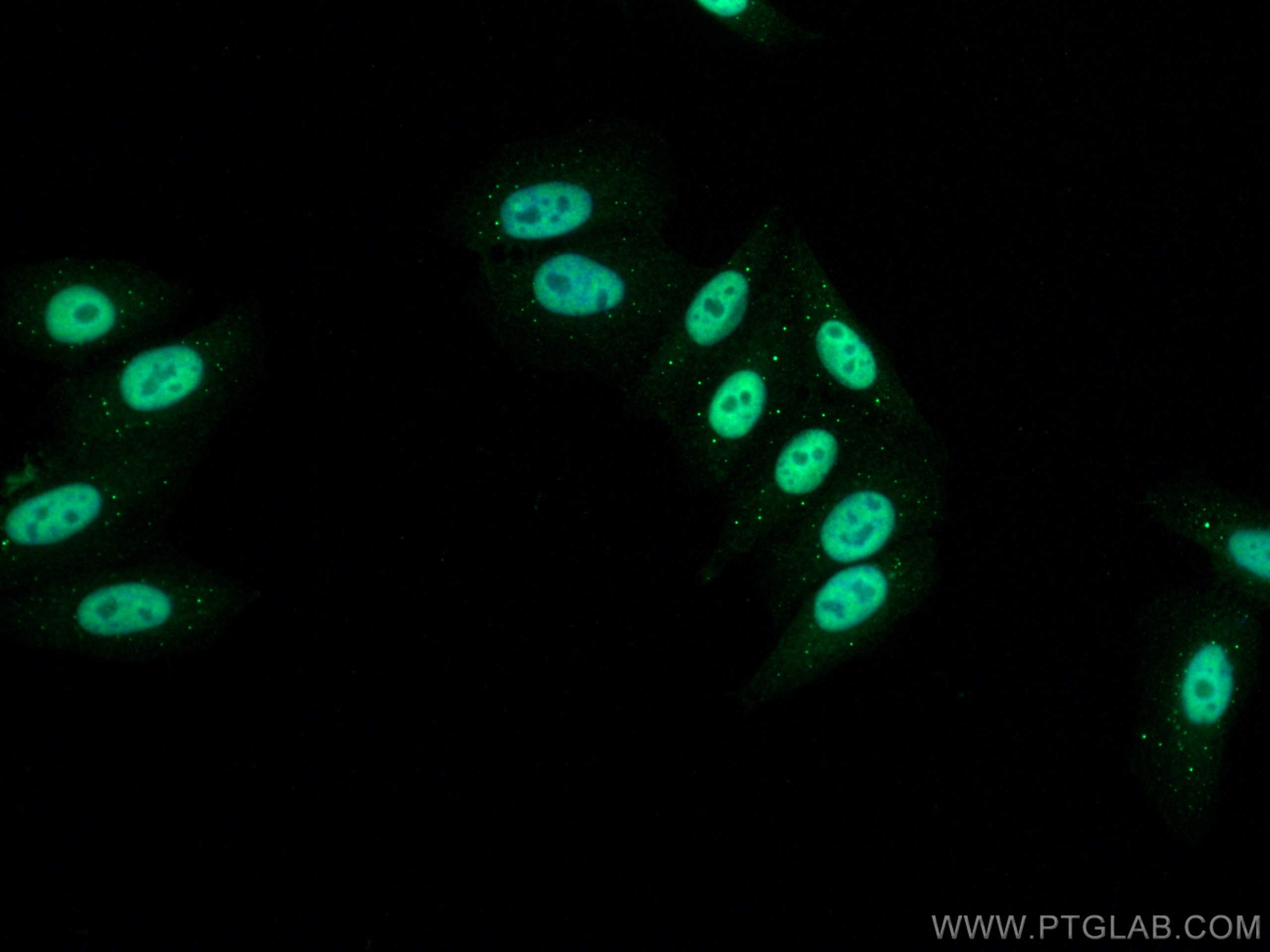 IF Staining of HepG2 using 21625-1-AP (same clone as 21625-1-PBS)