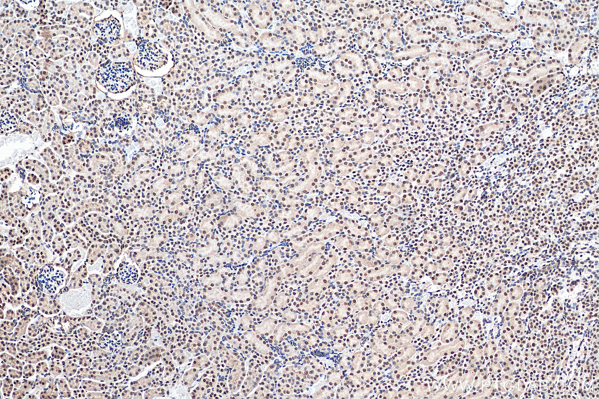 IHC staining of mouse kidney using 21625-1-AP (same clone as 21625-1-PBS)