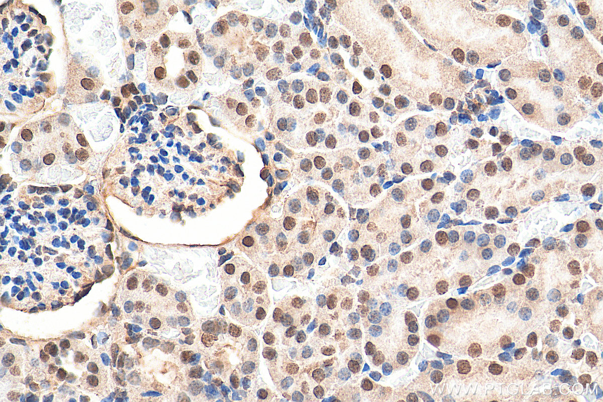 IHC staining of mouse kidney using 21625-1-AP (same clone as 21625-1-PBS)