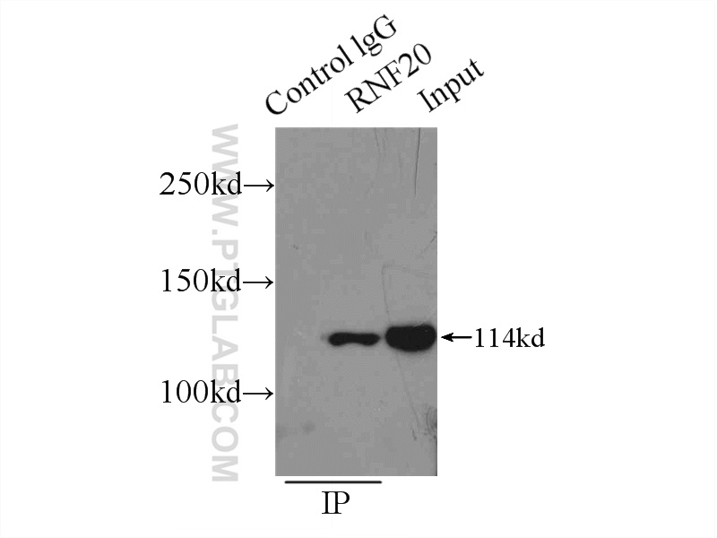 IP experiment of HeLa using 21625-1-AP (same clone as 21625-1-PBS)