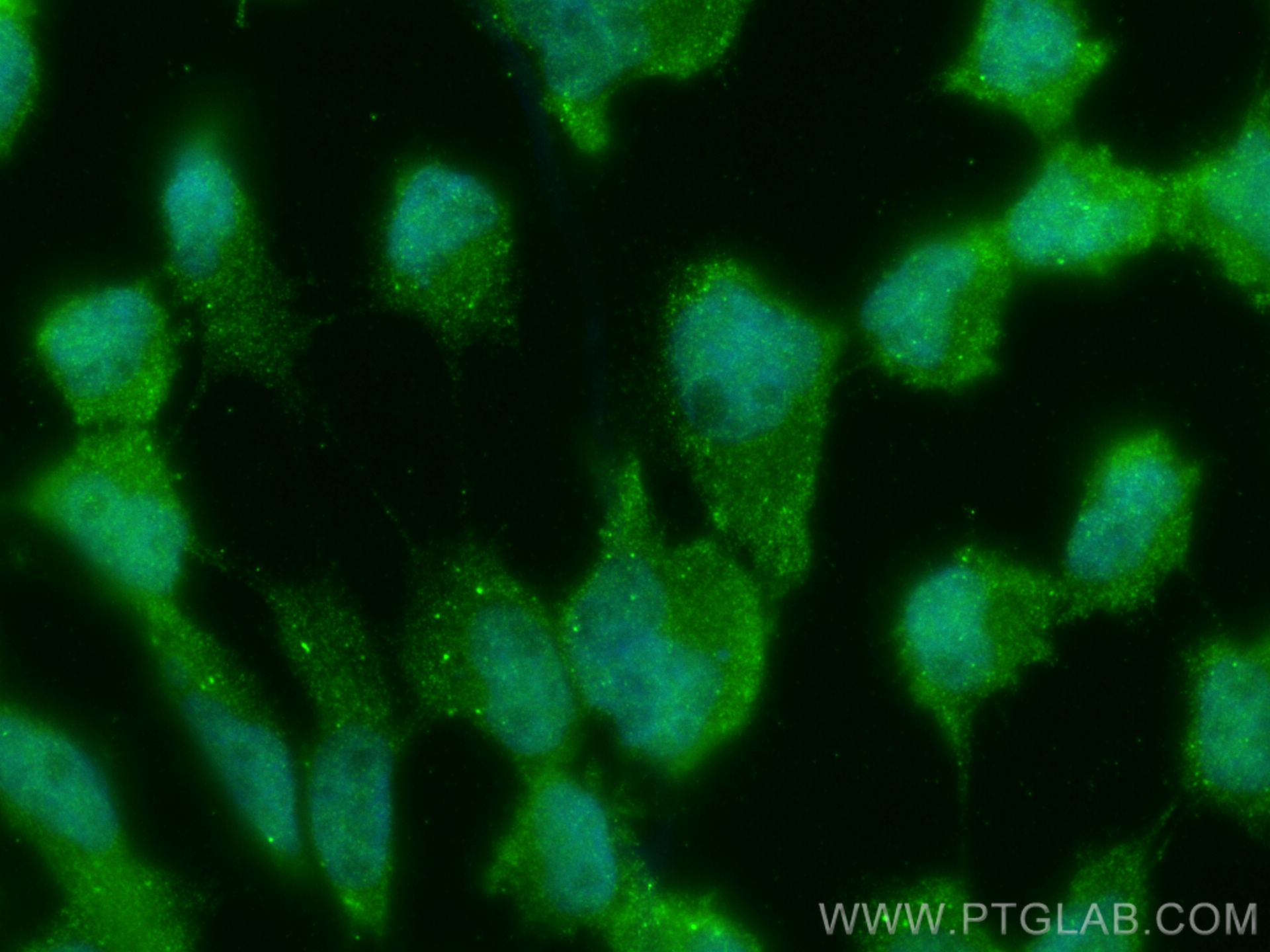 IF Staining of A431 using 10185-1-AP