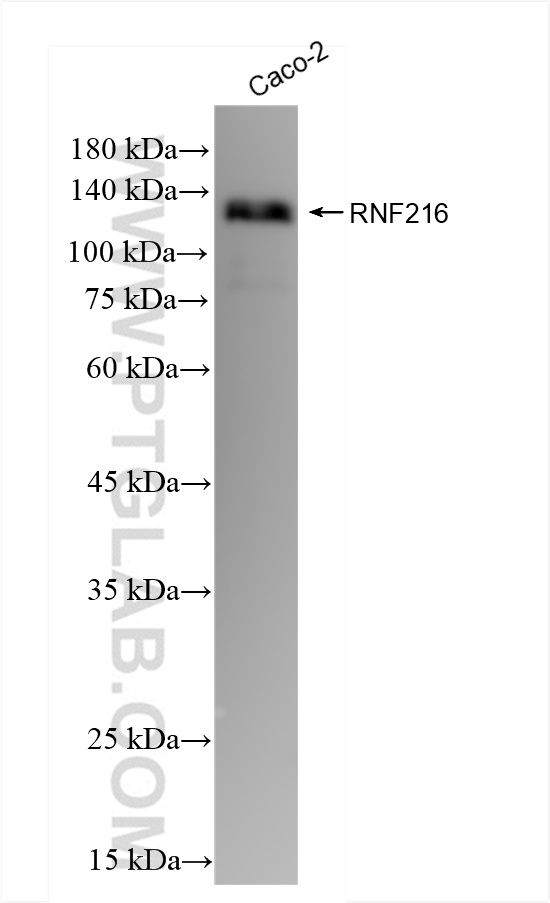 WB analysis of Caco-2 using 83658-2-RR