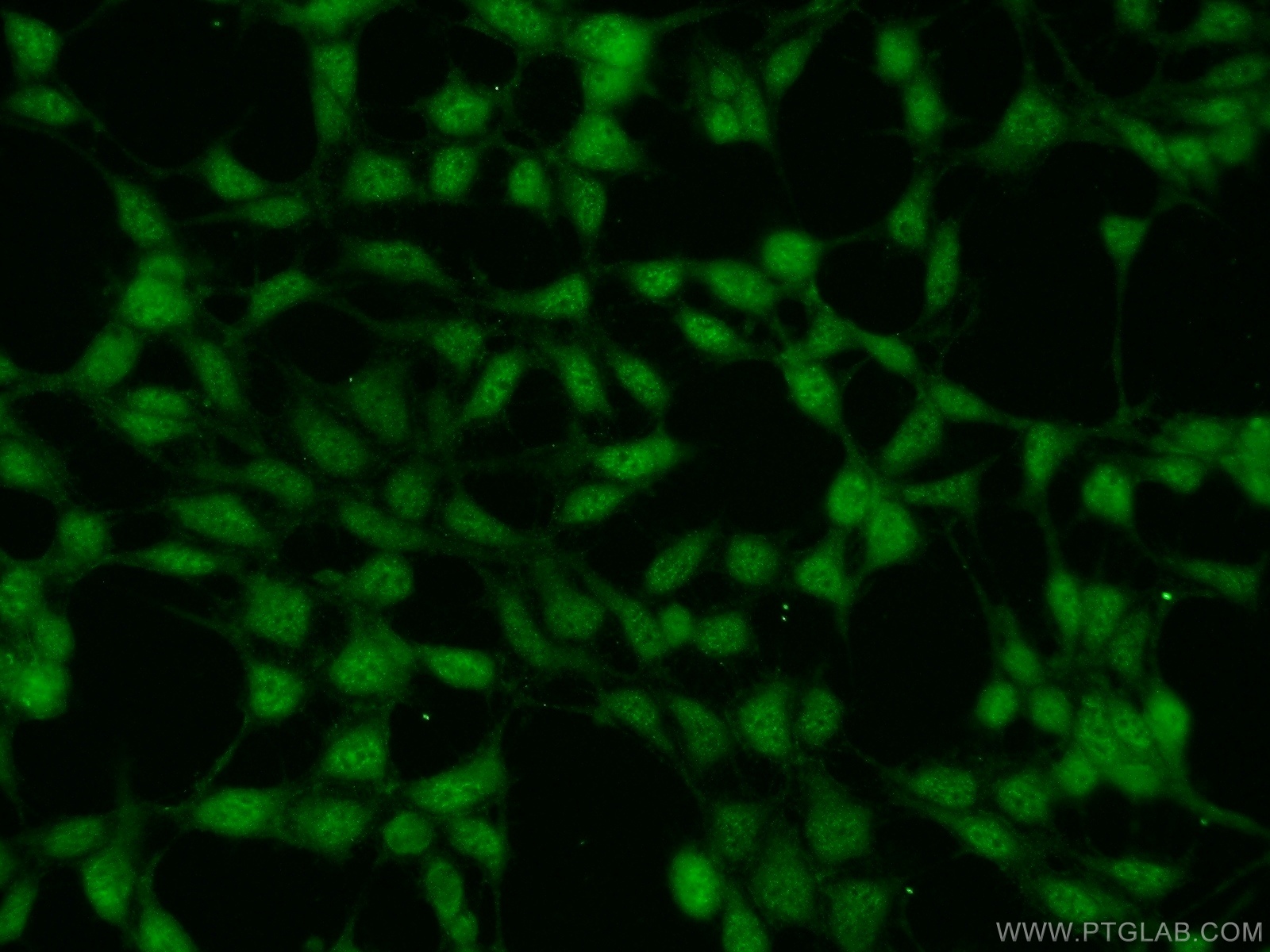 IF Staining of HEK-293 using 24988-1-AP