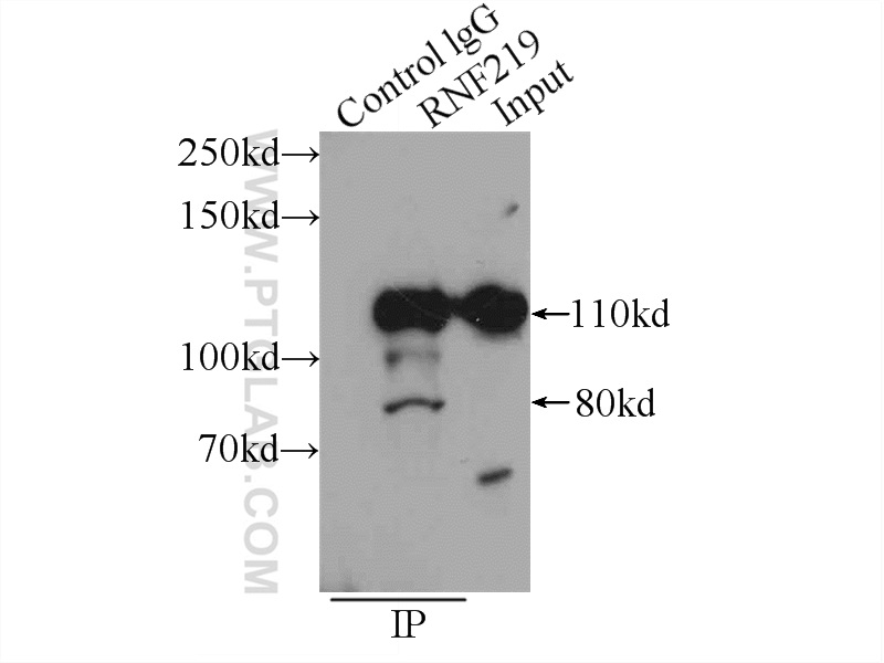 IP experiment of A431 using 24988-1-AP