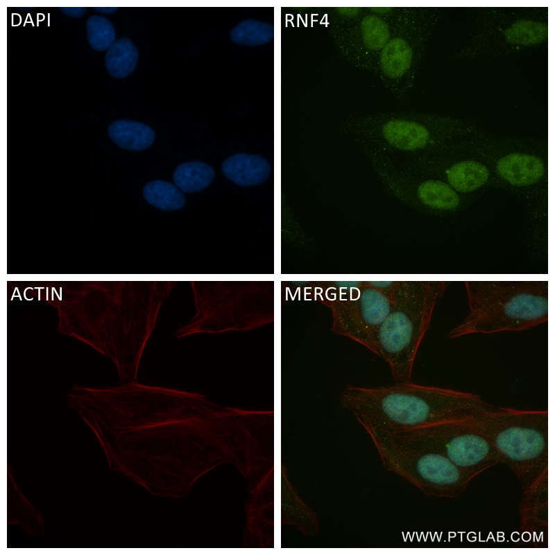 IF Staining of HepG2 using 84770-1-RR (same clone as 84770-1-PBS)