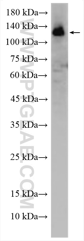 WB analysis of HEK-293 using 15621-1-AP