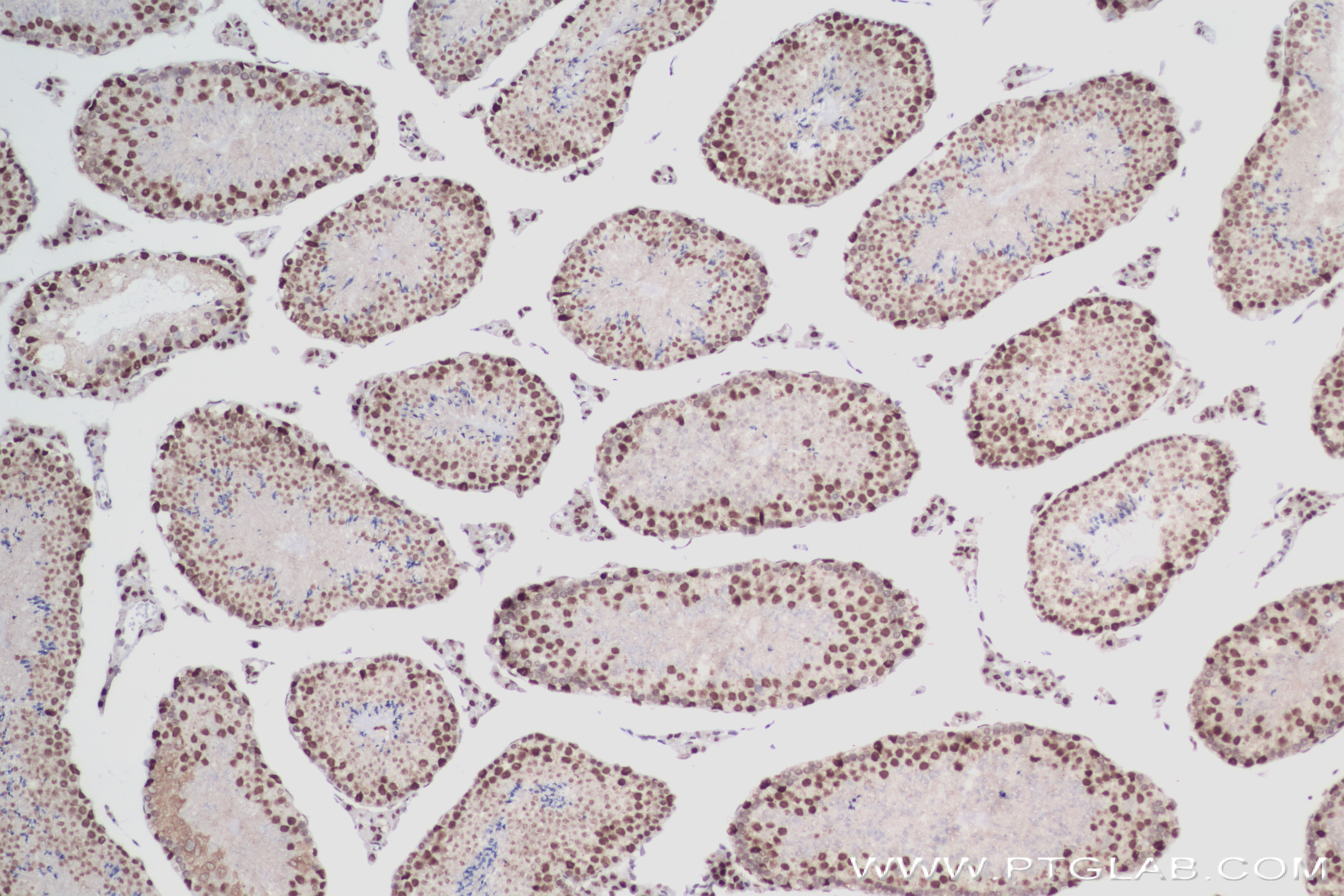 IHC staining of mouse testis using 84058-4-RR