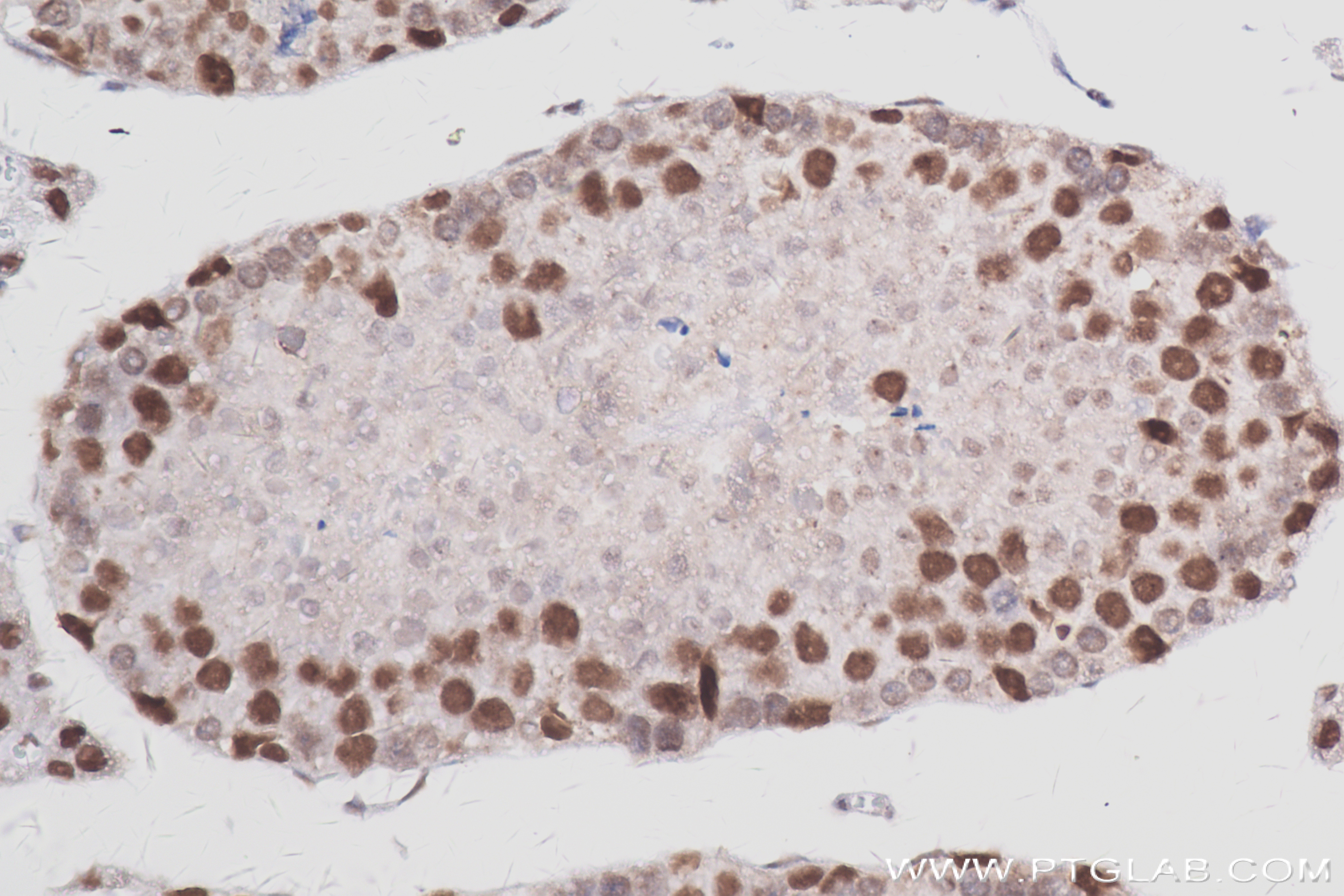 IHC staining of mouse testis using 84058-4-RR