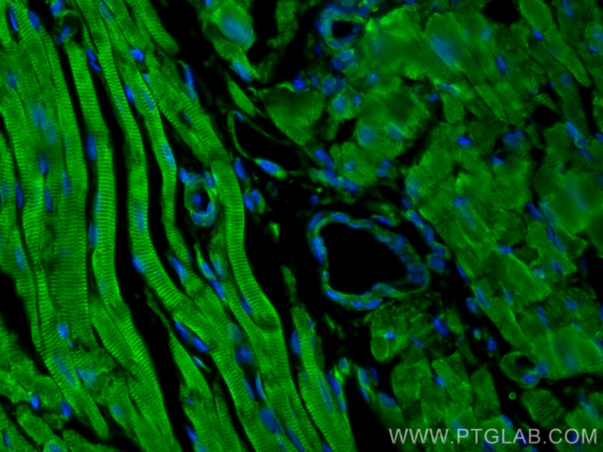 IF Staining of mouse heart using 11905-1-AP