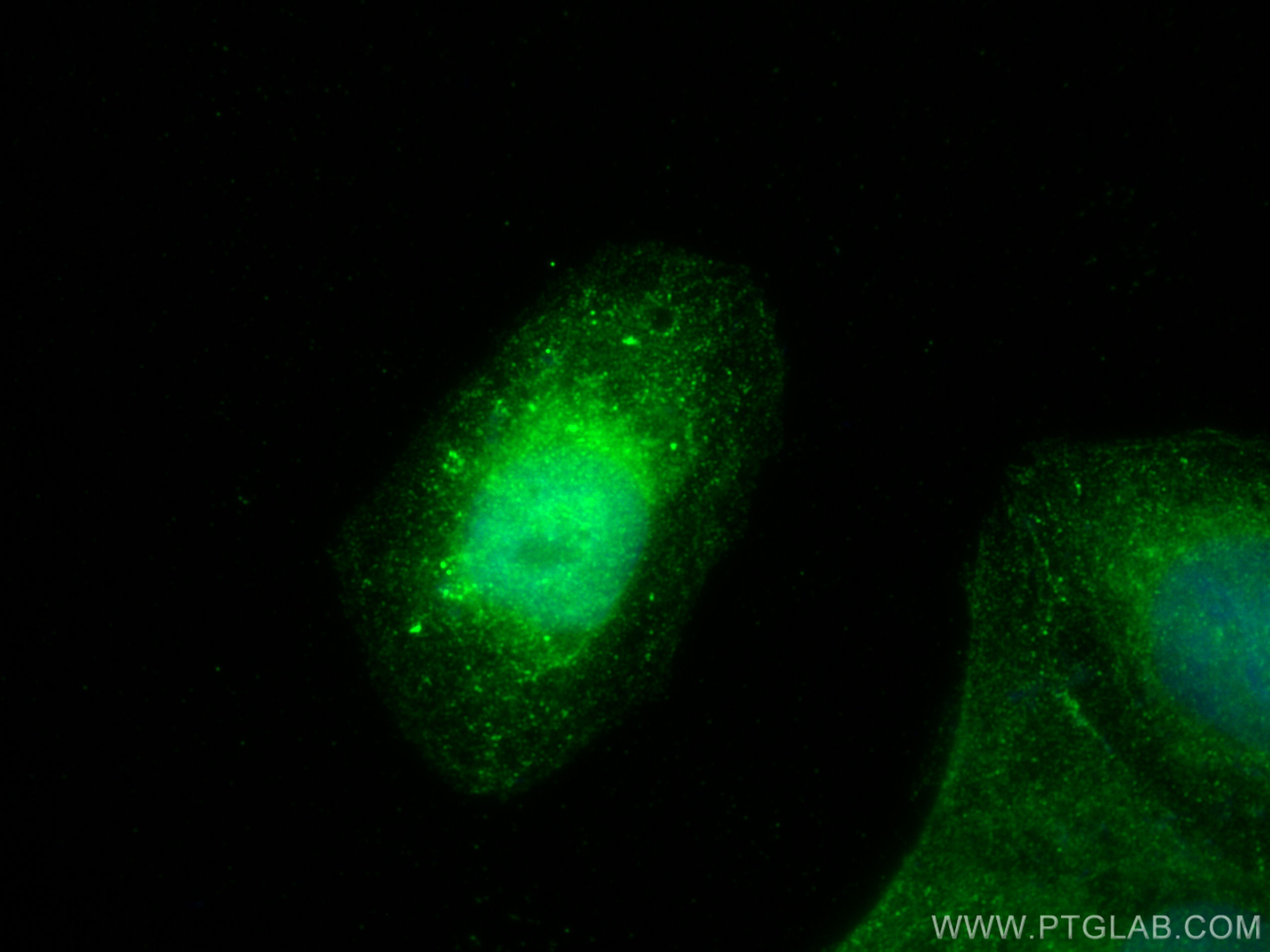 IF Staining of U2OS using 11905-1-AP