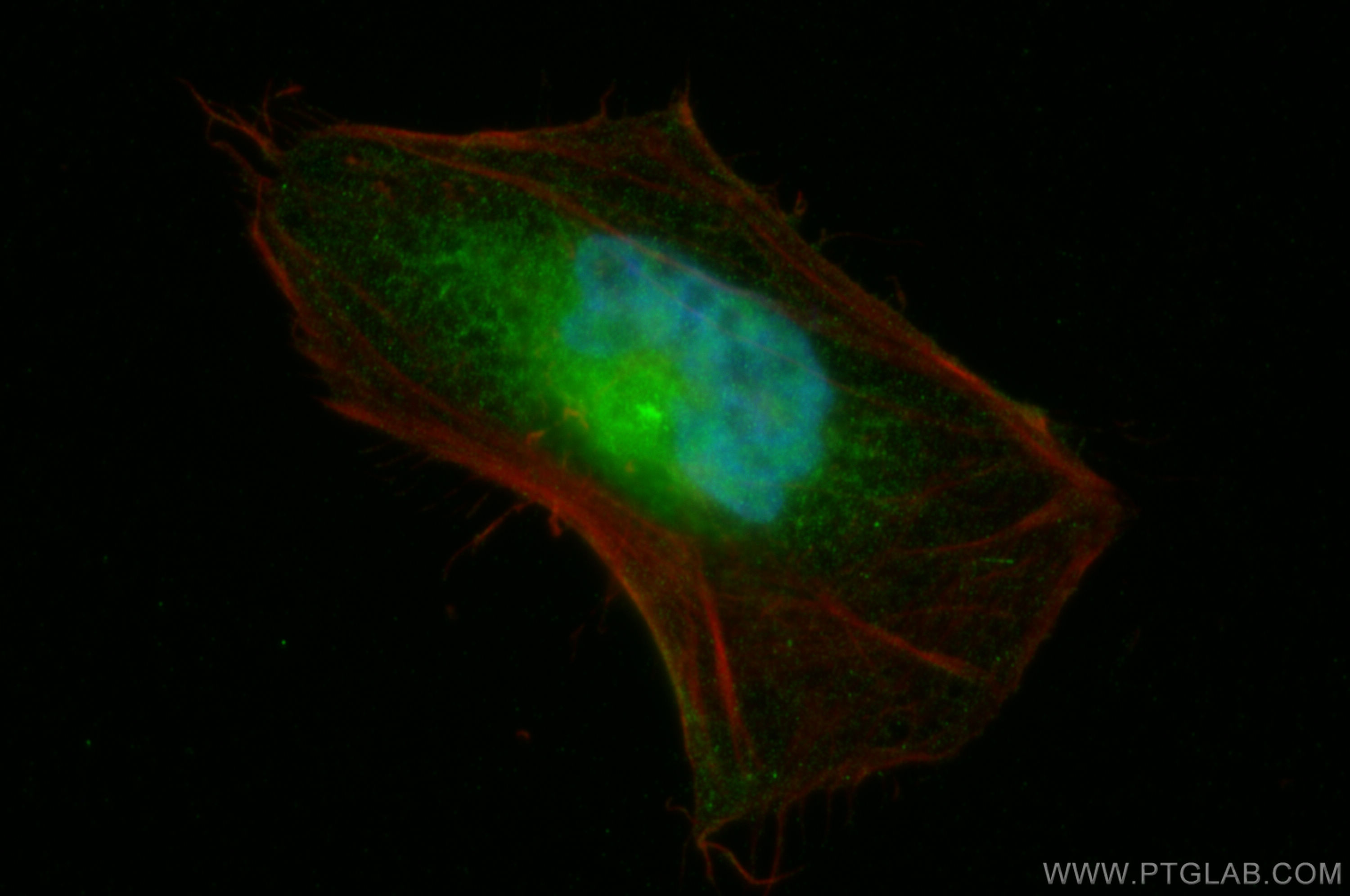 IF Staining of HeLa using 14112-1-AP