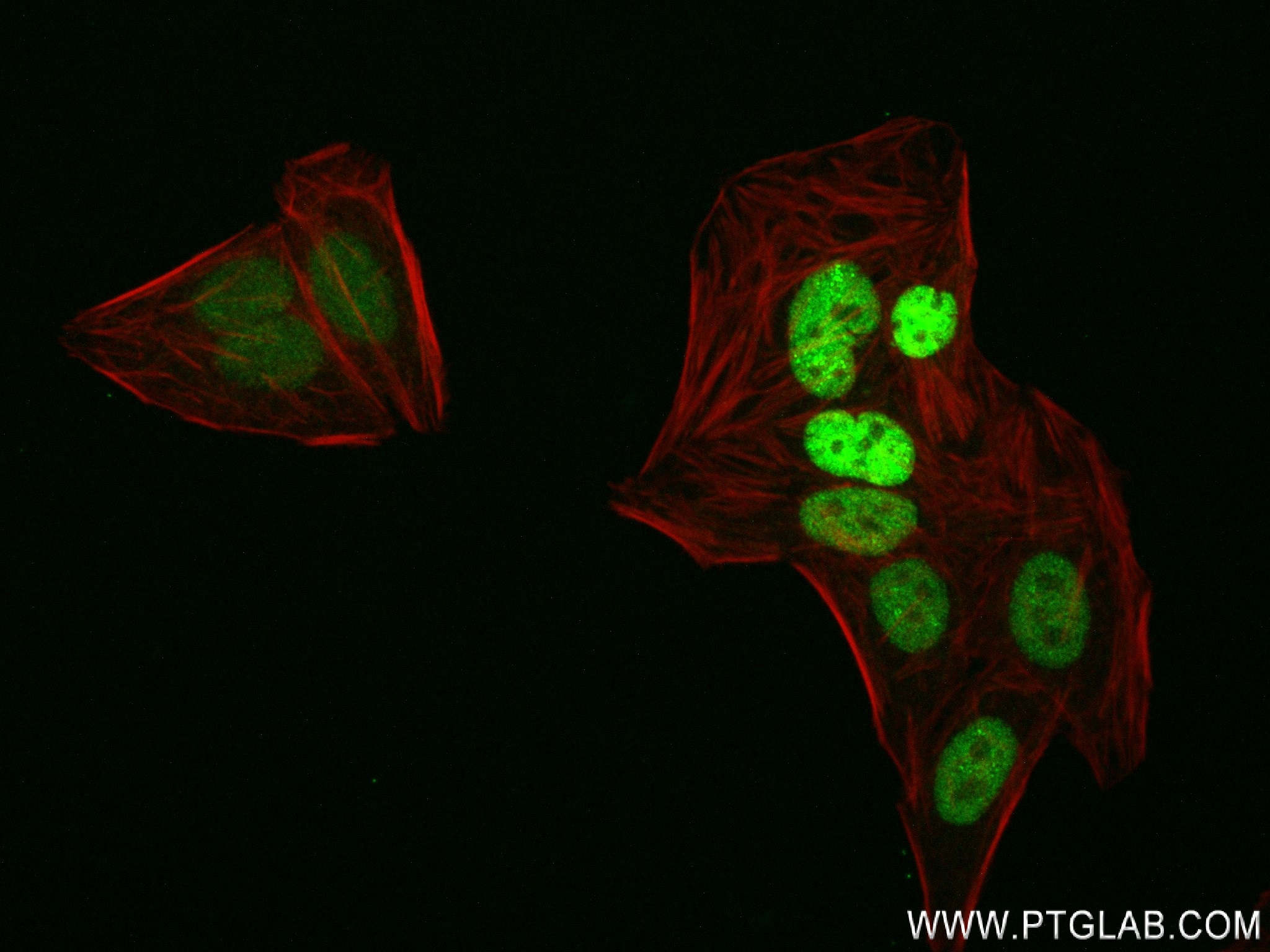 IF Staining of HepG2 using 83974-4-RR