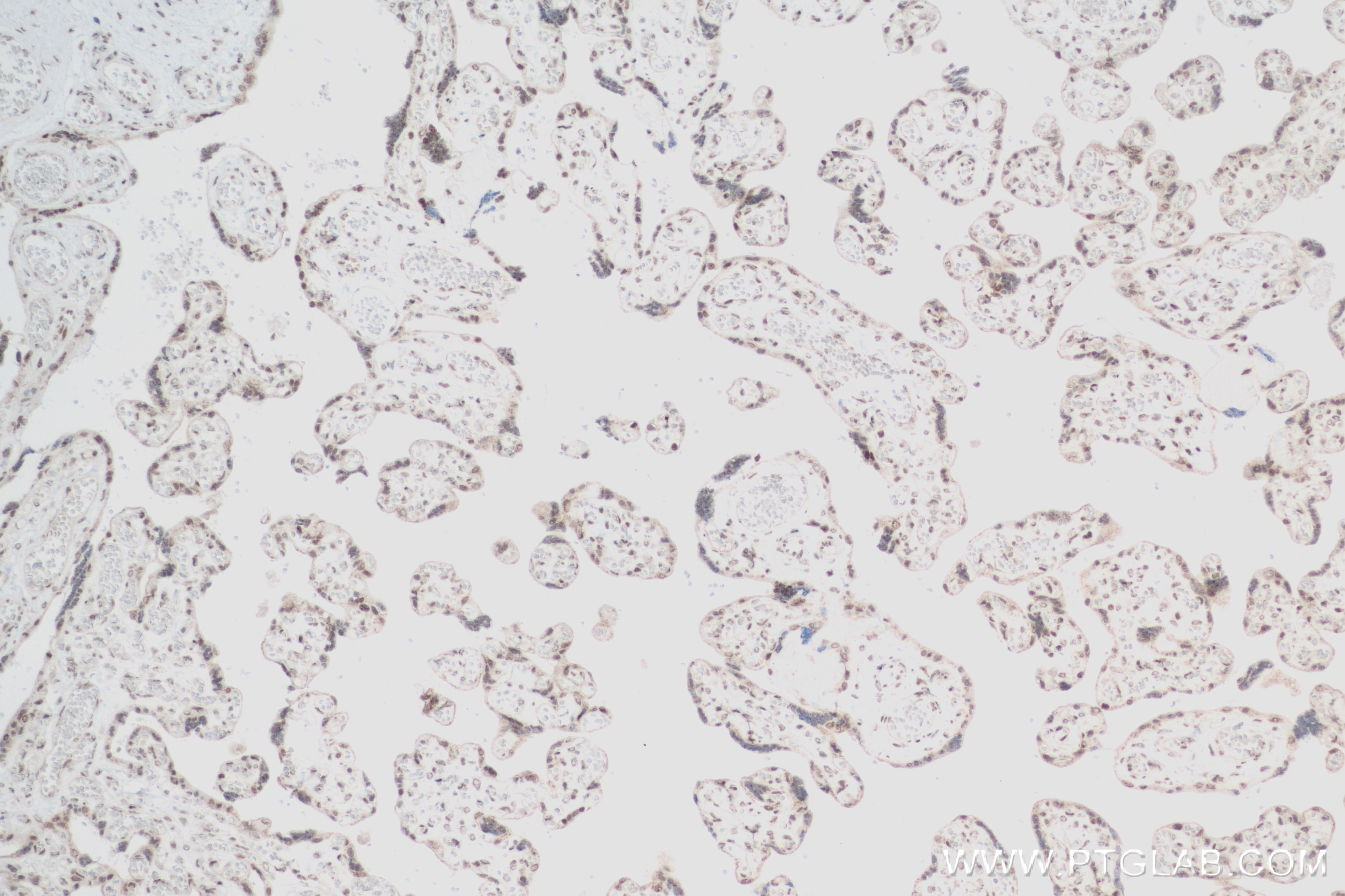 IHC staining of human placenta using 83974-4-RR