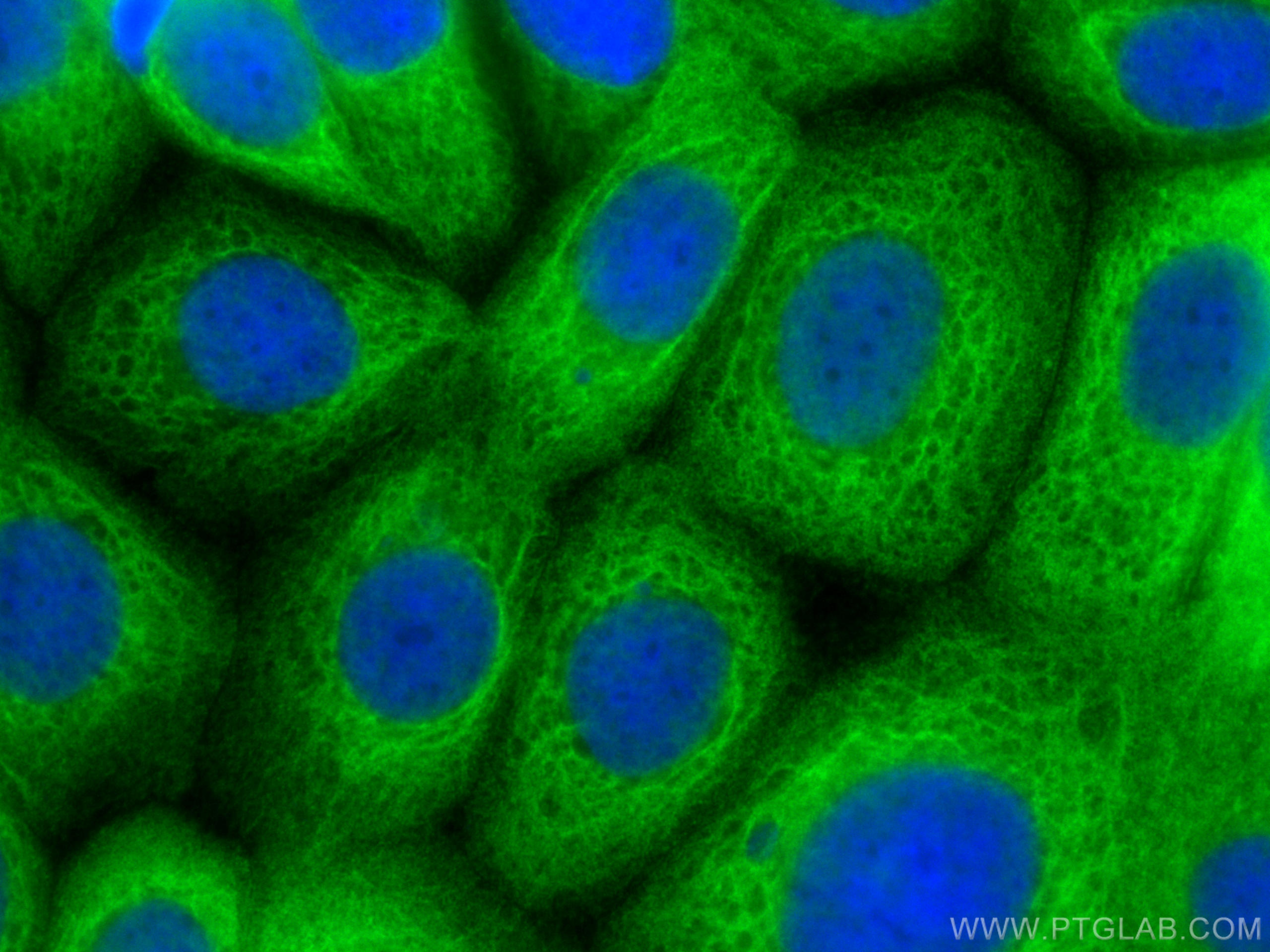 IF Staining of MCF-7 using 10345-1-AP