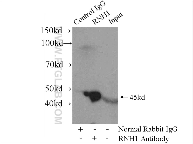 IP experiment of mouse liver using 10345-1-AP