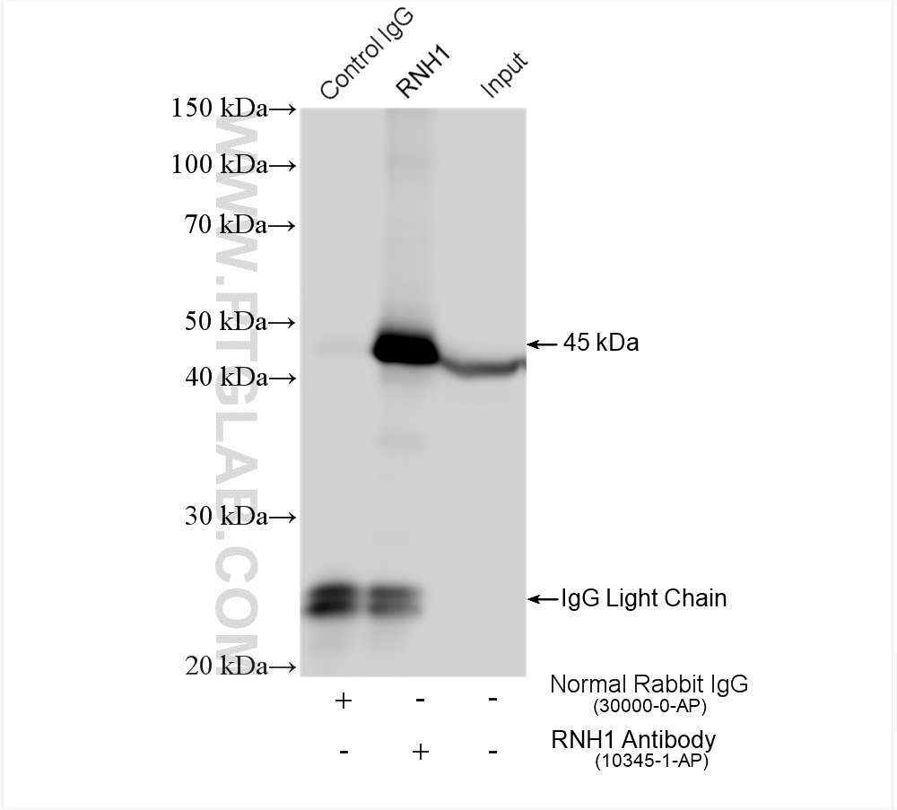 IP experiment of HEK-293T using 10345-1-AP