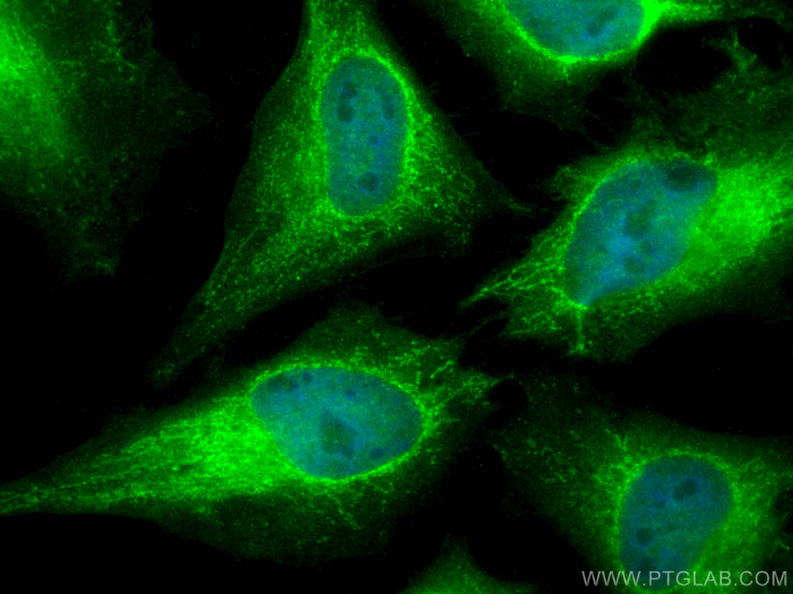 IF Staining of HeLa using 14707-1-AP