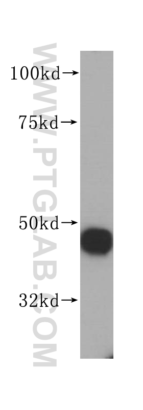 WB analysis of HeLa using 14707-1-AP