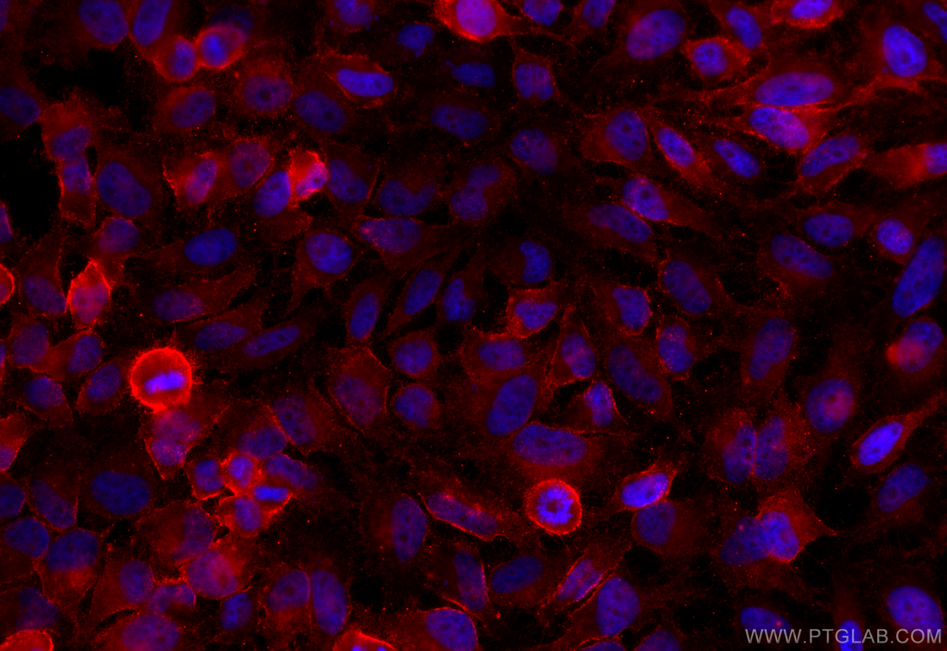 IF Staining of HeLa using 25181-1-AP