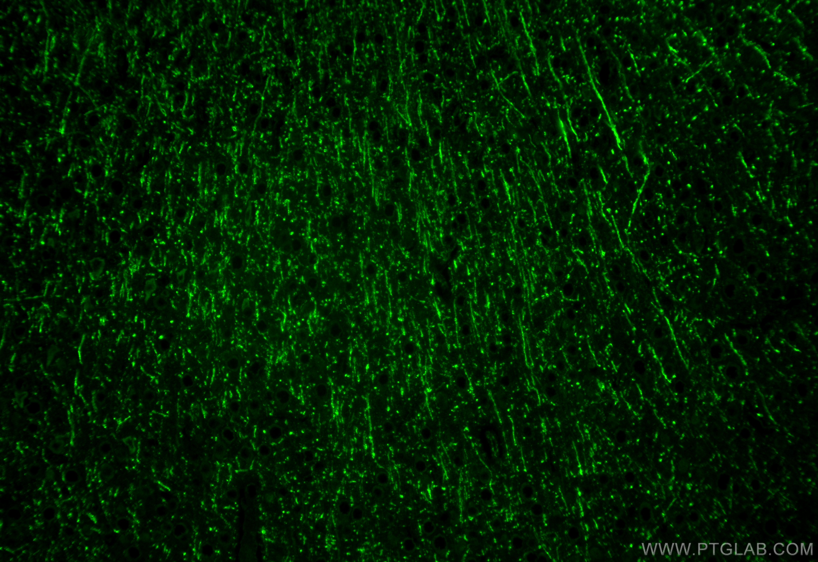 IF Staining of mouse brain using 25181-1-AP