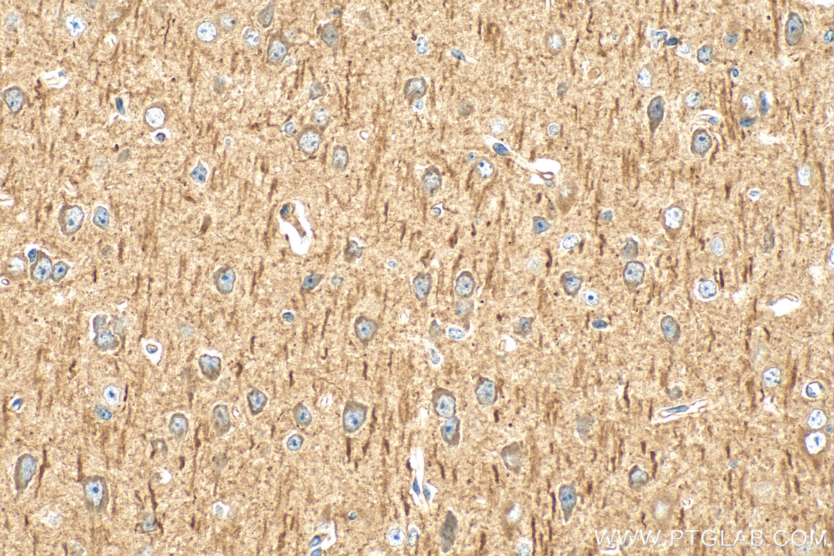 IHC staining of mouse brain using 25181-1-AP