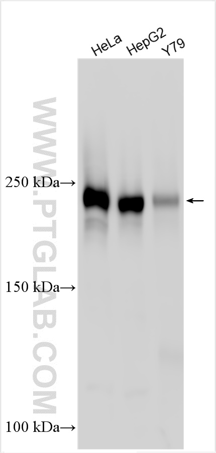 WB analysis using 25181-1-AP