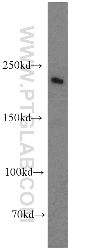 ROBO1-Specific Polyclonal antibody