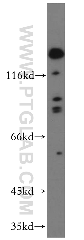 WB analysis of HeLa using 20221-1-AP