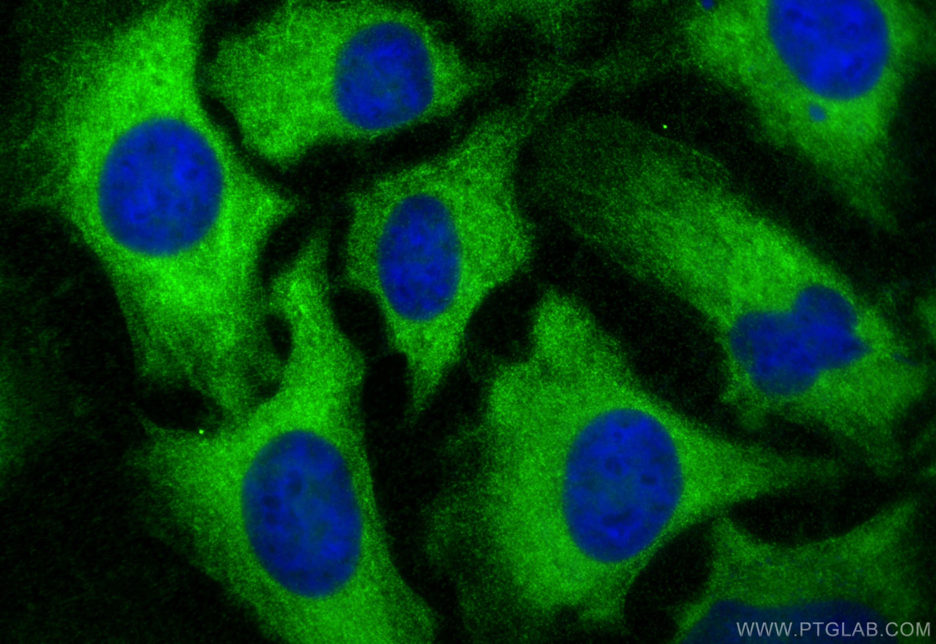 IF Staining of HeLa using 21850-1-AP