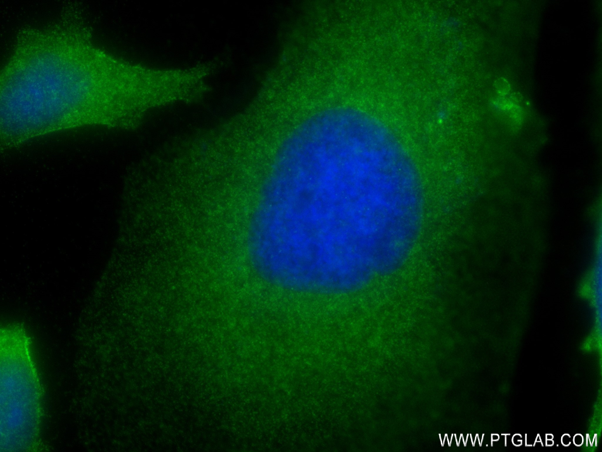 IF Staining of HeLa using 83166-5-RR (same clone as 83166-5-PBS)