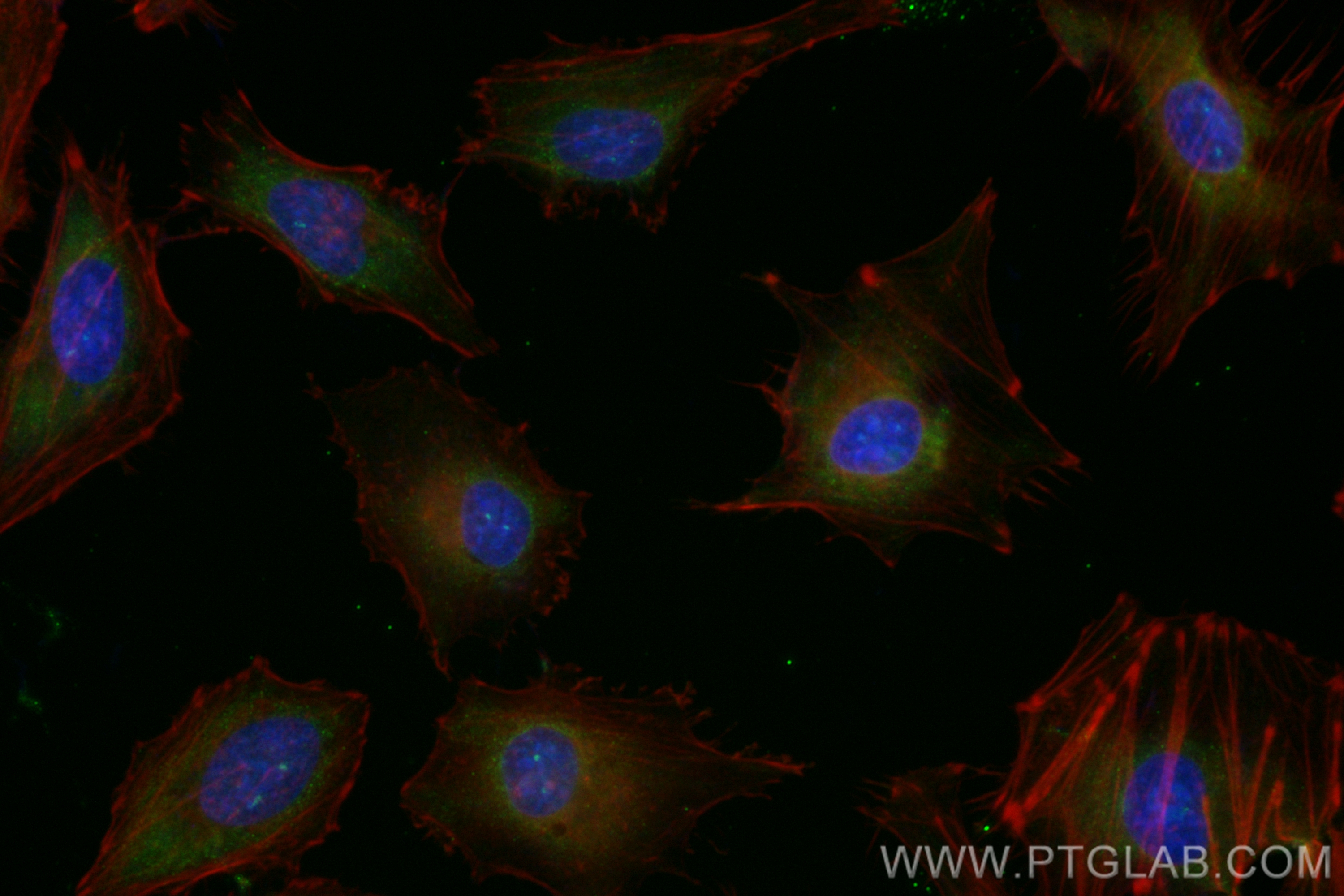 IF Staining of HeLa using CL488-83166-5