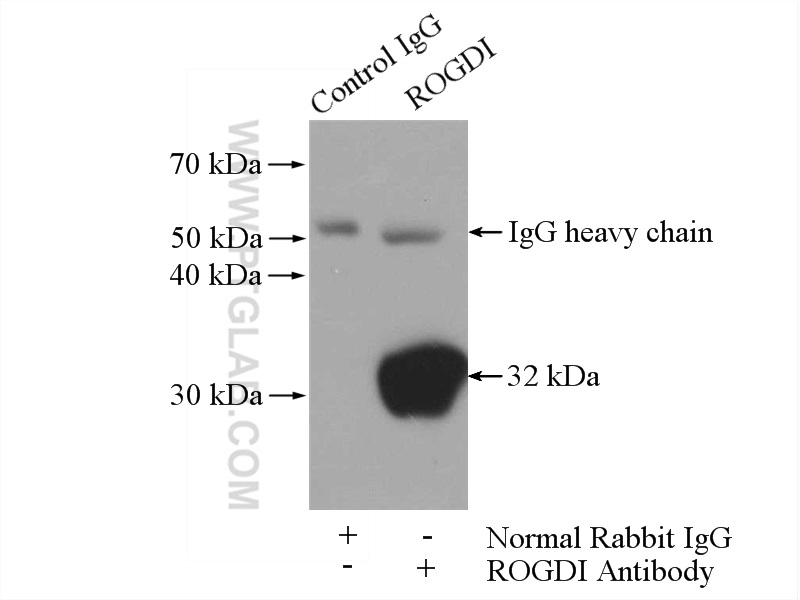 IP experiment of mouse brain using 17047-1-AP