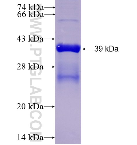 ROR1 fusion protein Ag14586 SDS-PAGE