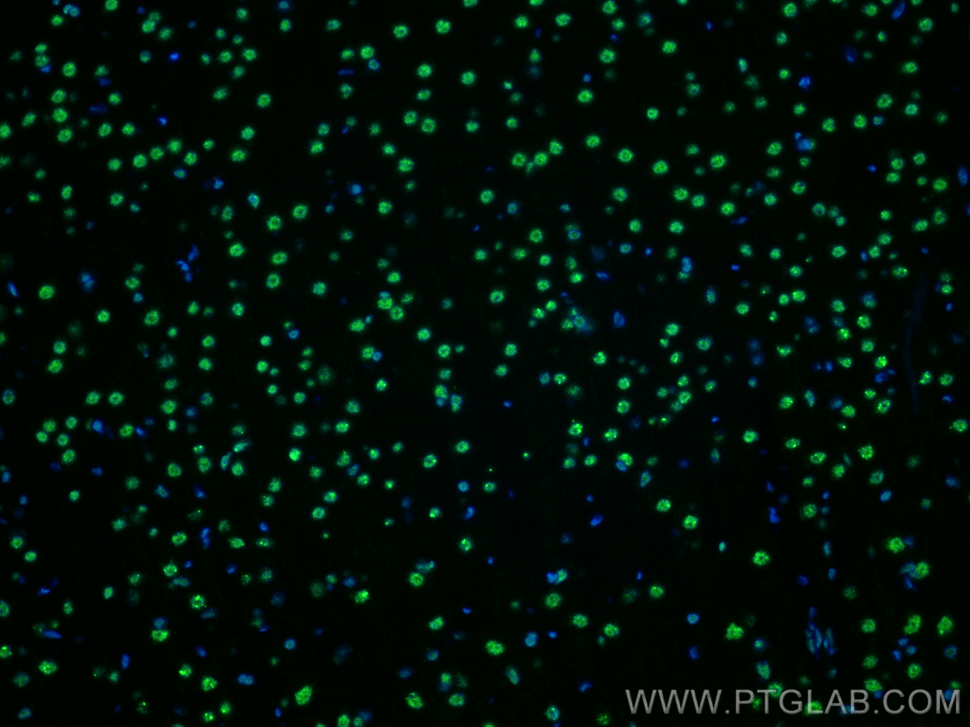 IF Staining of rat brain using 82930-1-RR