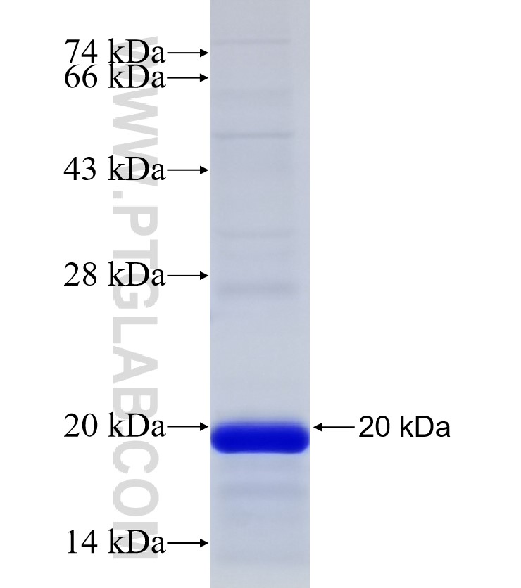 RORA fusion protein Ag32574 SDS-PAGE