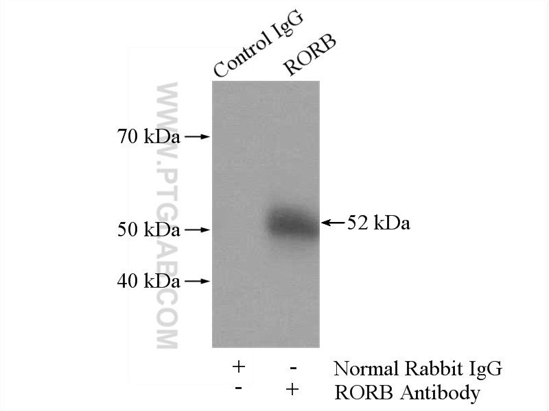 IP experiment of mouse brain using 17635-1-AP