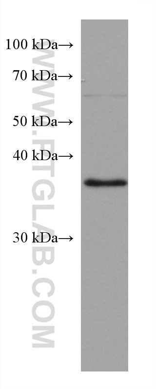 WB analysis of HepG2 using 67795-1-Ig