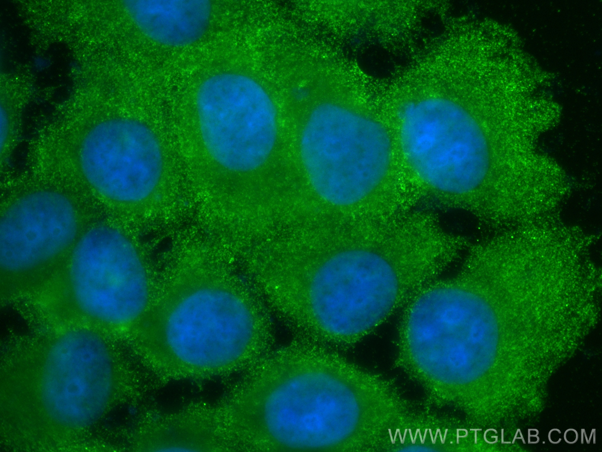 IF Staining of MCF-7 using 10847-1-AP