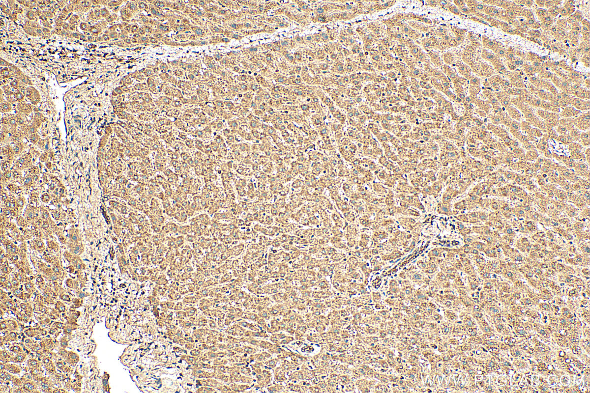 IHC staining of human liver using 10847-1-AP